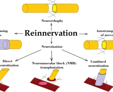 41016_2019_151_Fig1_HTML